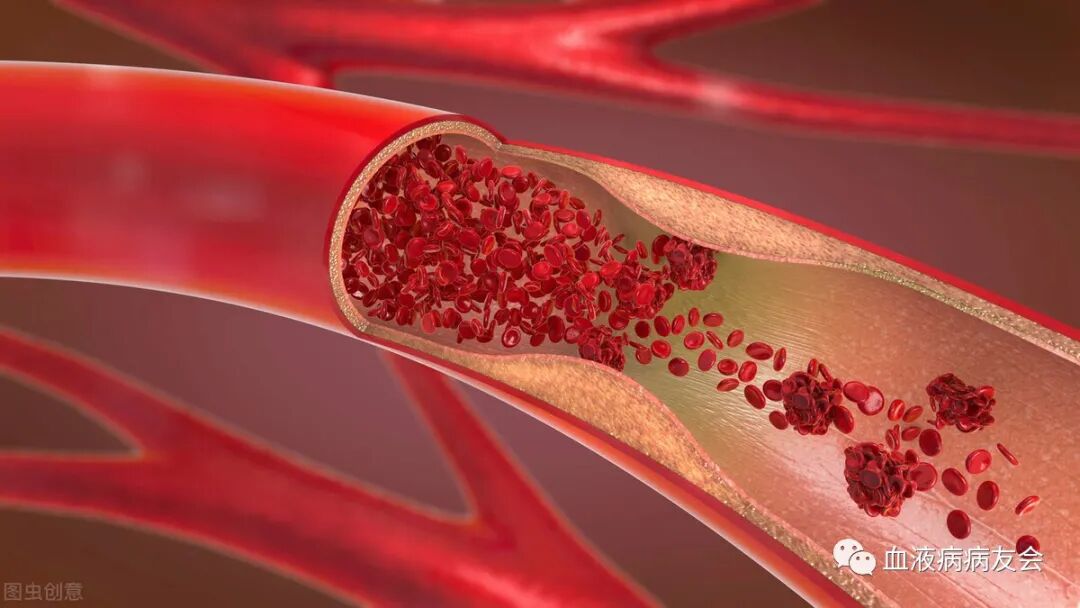 凝血功能障碍能治好吗