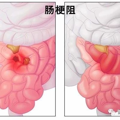 cover_image