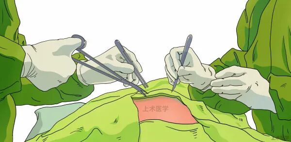 缝合线怎么消毒关于急诊清创缝合术必须掌握的知识_https://www.jmylbn.com_新闻资讯_第3张