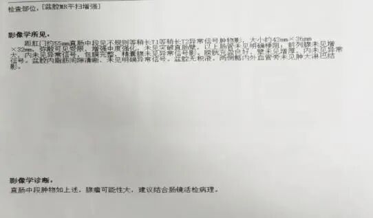圈套器品牌有哪些品牌技术 ｜ 肛门保卫战—ESD手术带来福音_https://www.jmylbn.com_新闻资讯_第8张