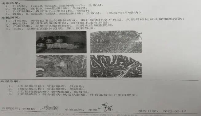 圈套器品牌有哪些品牌技术 ｜ 肛门保卫战—ESD手术带来福音_https://www.jmylbn.com_新闻资讯_第4张