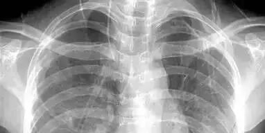 体检dr是什么意思【傻傻分不清楚】DR、CT、彩超，体检中哪一项才是最佳选择？一分钟读懂！_https://www.jmylbn.com_新闻资讯_第15张