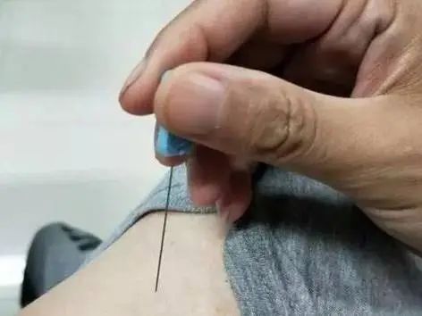 小针刀，作用大——带你了解小针刀是如何治疗疾病的