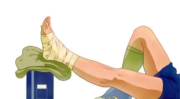 fa6100怎么使用【健康科普】“小意外”可能引出大麻烦——落枕、闪腰、崴脚怎么办？_https://www.jmylbn.com_新闻资讯_第12张