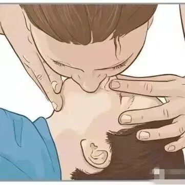 aed电极贴怎么贴红科普 ｜ 如何正确使用AED？_https://www.jmylbn.com_新闻资讯_第8张