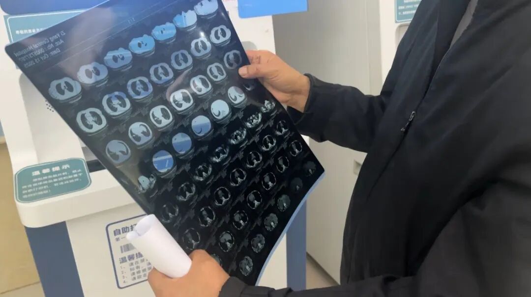 ct自助取片怎么资观帮忙 ｜ 就医检查的实体胶片为啥要收费了？_https://www.jmylbn.com_新闻资讯_第4张