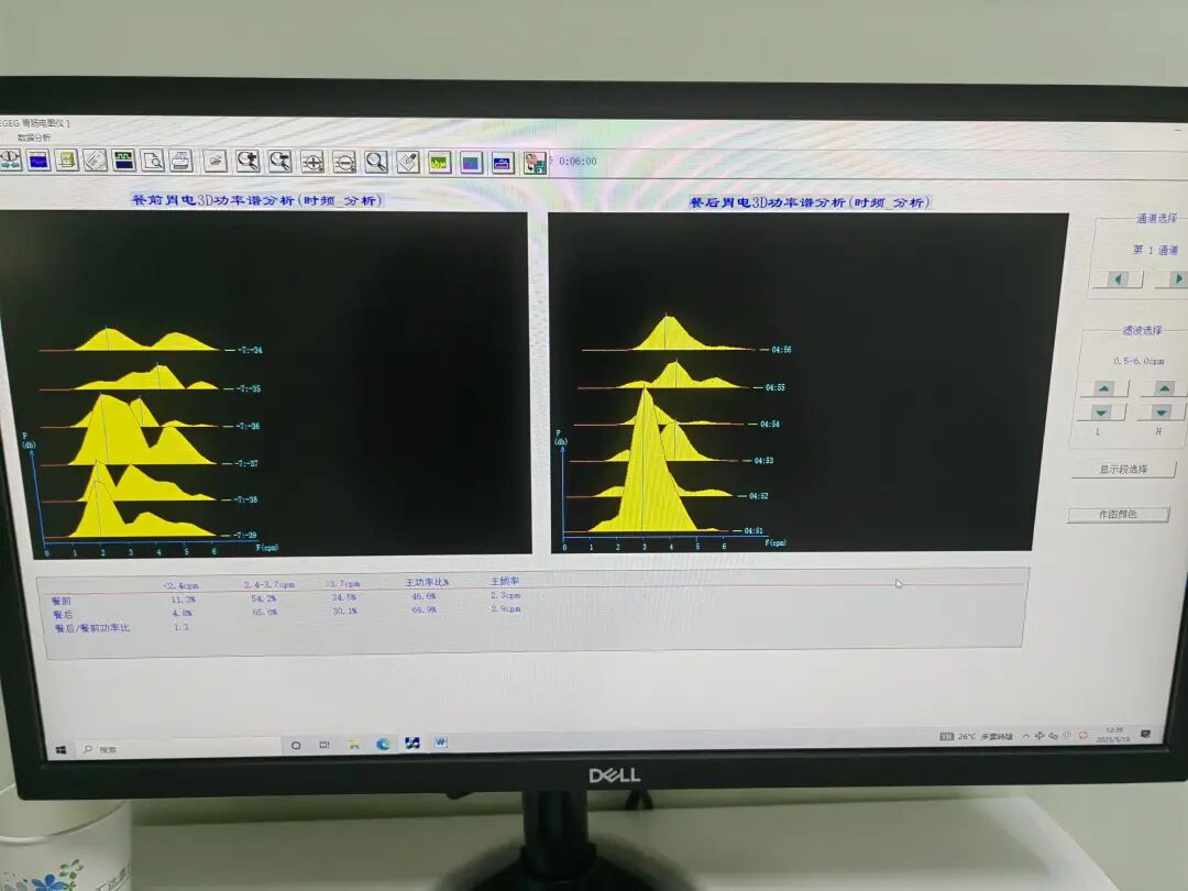 肠电图能查看什么【杏林科普】胃肠动力问题别着急，胃肠电图检查来帮您_https://www.jmylbn.com_新闻资讯_第6张