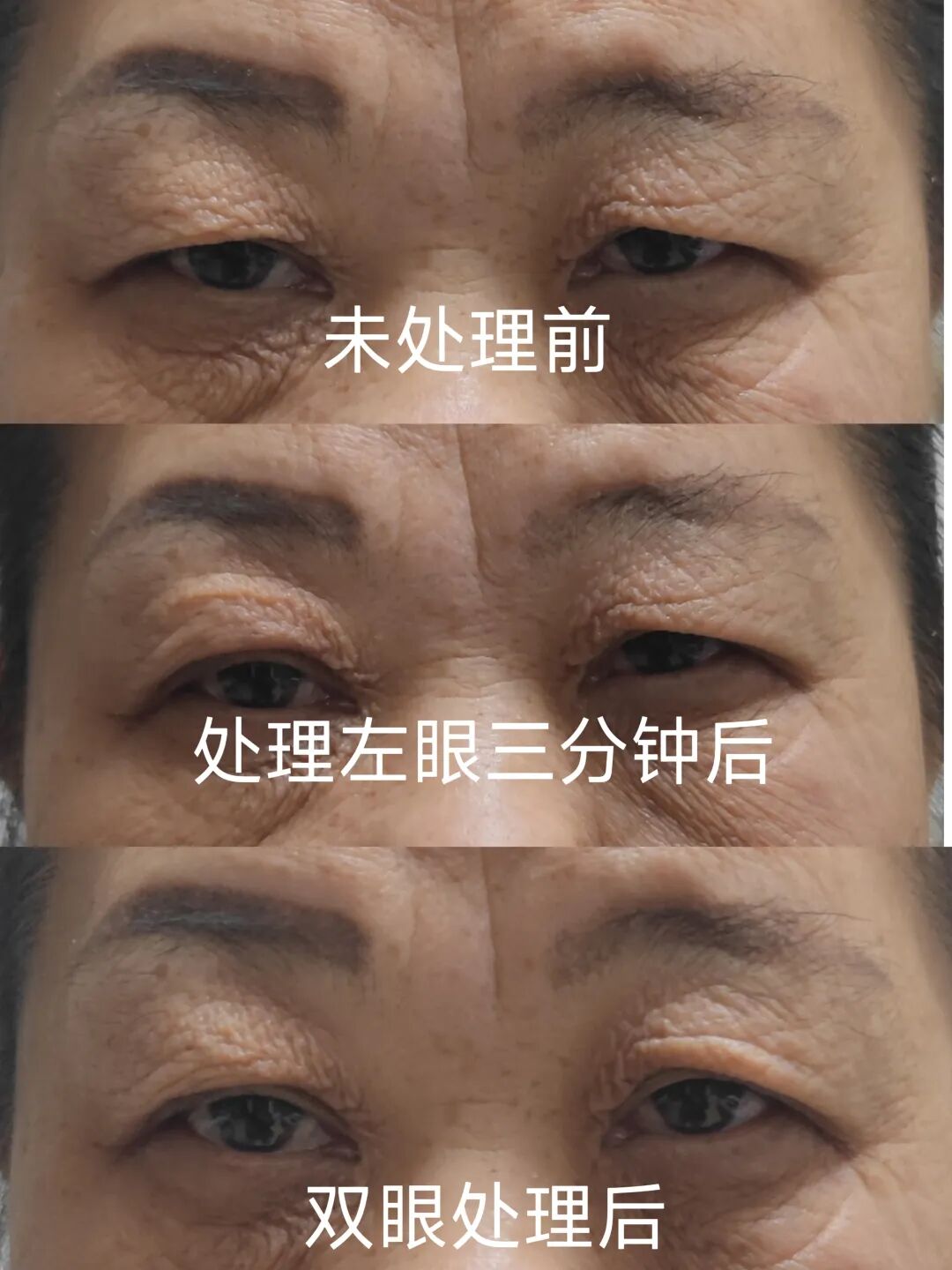 三分钟速效大眼术，亲妈实测超简单！骗人小狗都信了，眼睛瞬间放大秘诀公开