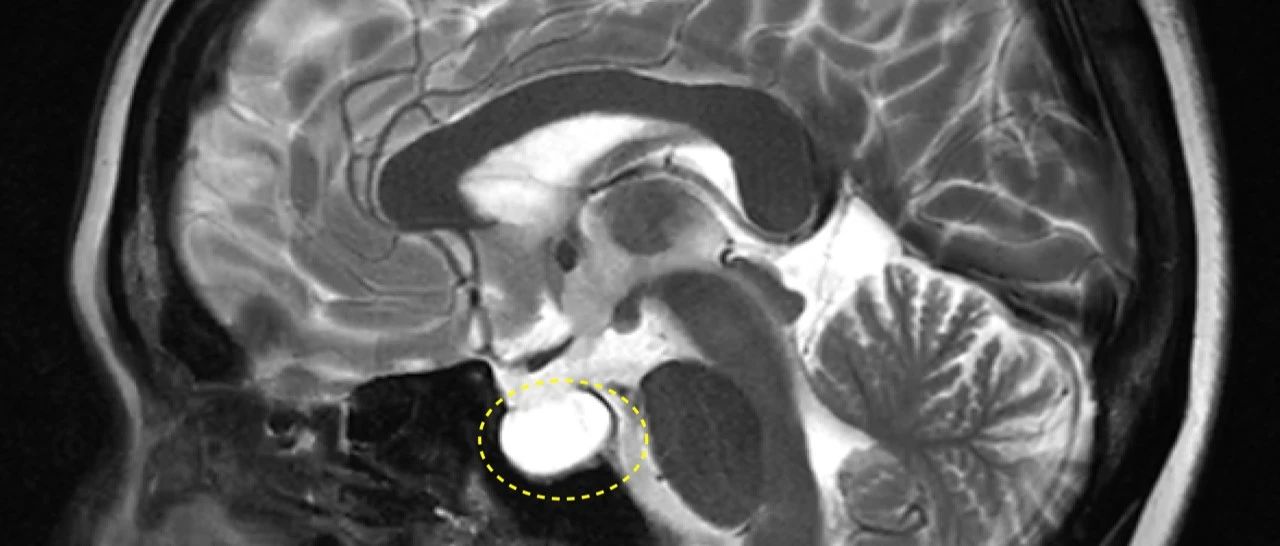 cover_image