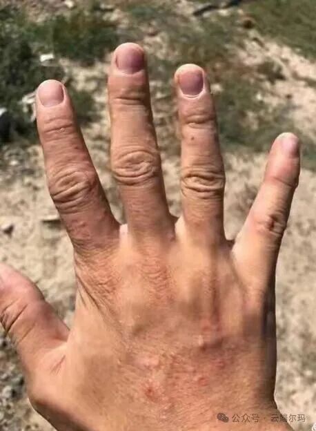 父亲的两三个小偏方