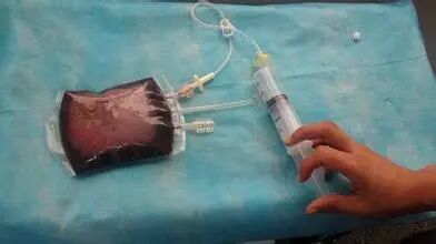 什么是大自血疗法疼痛科：臭氧大自血疗法_https://www.jmylbn.com_新闻资讯_第3张