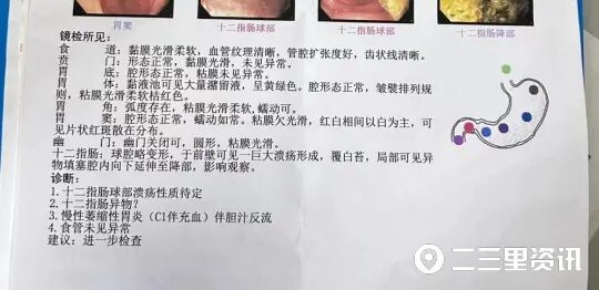 为什么医院的纱布不卖又有医疗机构出现“纱布遗留”问题！这一类护理不良事件，怎样预防？_https://www.jmylbn.com_新闻资讯_第4张