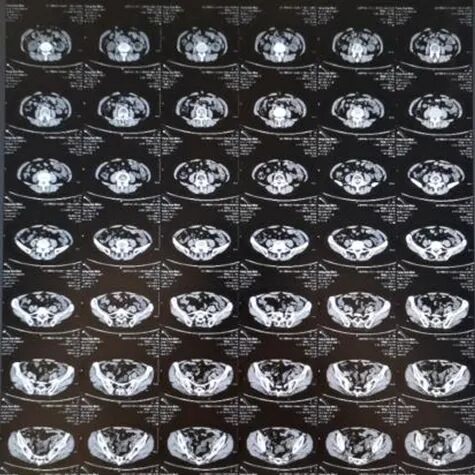 X光拍片为什么要等拍片选X光、CT还是磁共振？听听医生怎么说！_https://www.jmylbn.com_新闻资讯_第5张