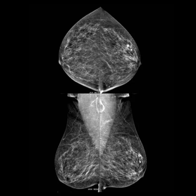 X光拍片为什么要等拍片选X光、CT还是磁共振？听听医生怎么说！_https://www.jmylbn.com_新闻资讯_第4张