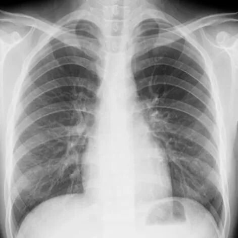 X光拍片为什么要等拍片选X光、CT还是磁共振？听听医生怎么说！_https://www.jmylbn.com_新闻资讯_第3张