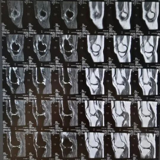 X光拍片为什么要等拍片选X光、CT还是磁共振？听听医生怎么说！_https://www.jmylbn.com_新闻资讯_第6张