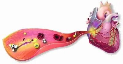了解他汀类药物的副作用......