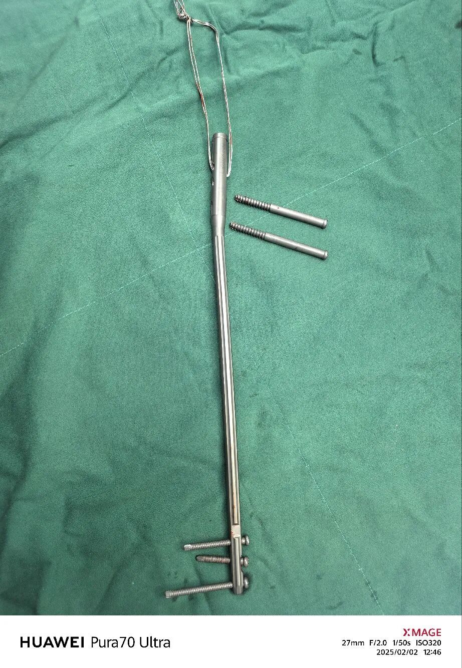 股骨干骨折，为什么“能闭合，不切开；能髓内，不钢板；能顺应，不逆行。”