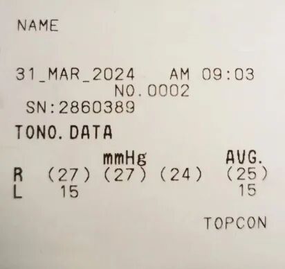 goldmann眼压计怎么读科普｜眼压测量的金标准是什么？_https://www.jmylbn.com_新闻资讯_第19张