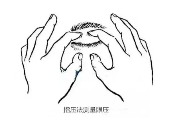 goldmann眼压计怎么读科普｜眼压测量的金标准是什么？_https://www.jmylbn.com_新闻资讯_第16张