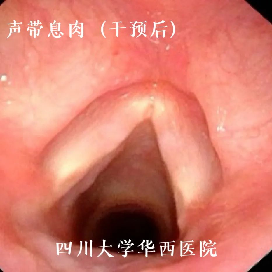 【世界嗓音日】悦耳嗓音从娃娃抓起