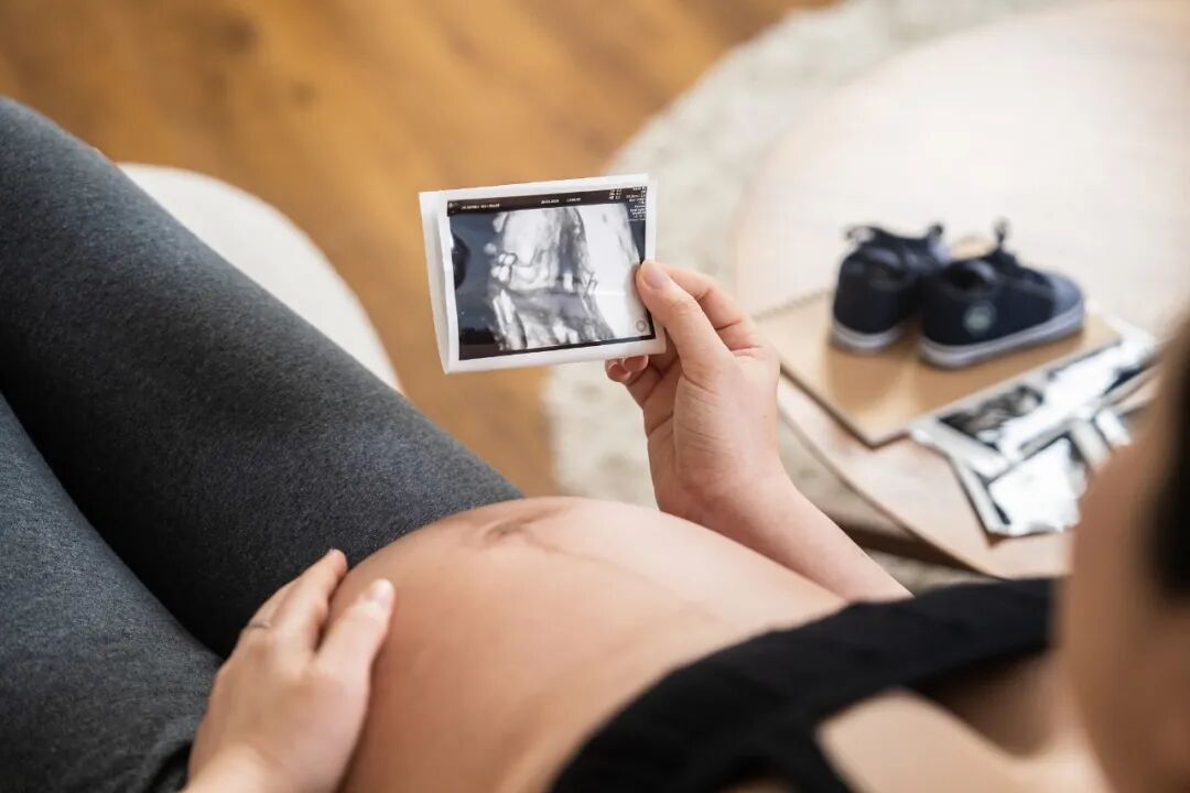 拍个胎儿写真就能知道男女，谁在提供方便？(图5)