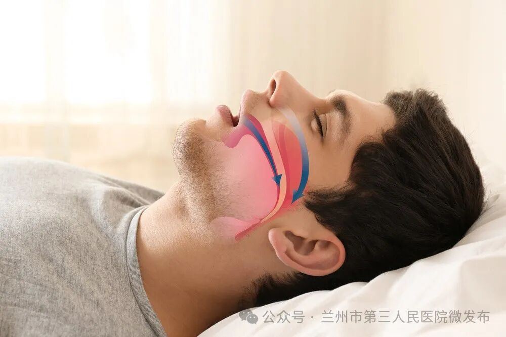 为什么呼吸机这么少【医院动态】总是打鼾睡不好，压力滴定少不了——睡眠医学科引进“家用呼吸机压力滴定系统”_https://www.jmylbn.com_新闻资讯_第1张