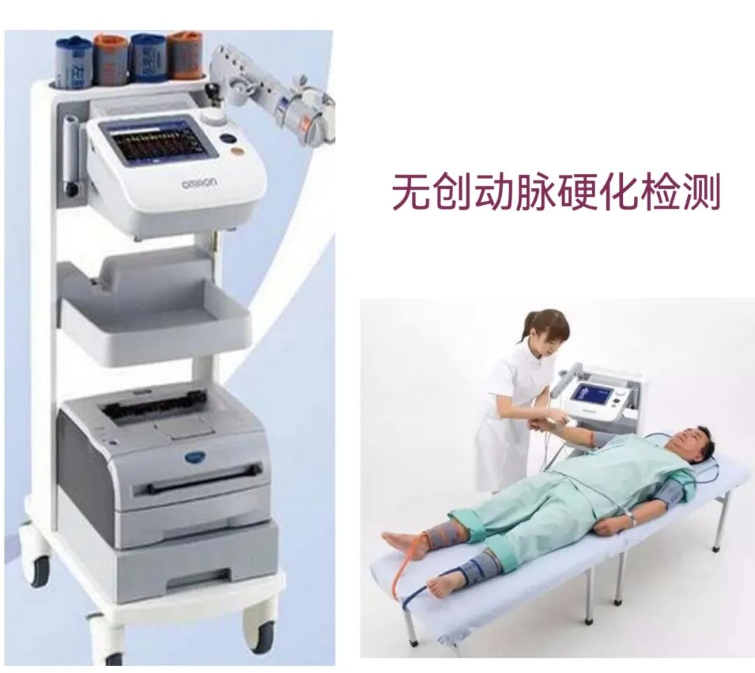 动脉硬化检测检查什么【科普】健康体检需要做动脉硬化检测吗？_https://www.jmylbn.com_新闻资讯_第9张