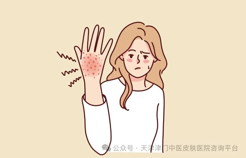 手足癣有哪些症状，你知多少？