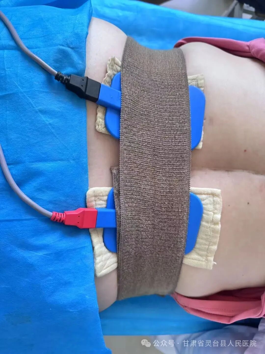 透药有什么作用【卫健动态】药穴结合，精准治疗——灵台县人民医院开展定向透药疗法_https://www.jmylbn.com_新闻资讯_第8张