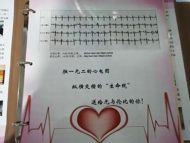 胎儿心电图是什么意思胎儿心电图：解读宝宝的健康密码，珍藏最初的心动瞬间_https://www.jmylbn.com_新闻资讯_第4张