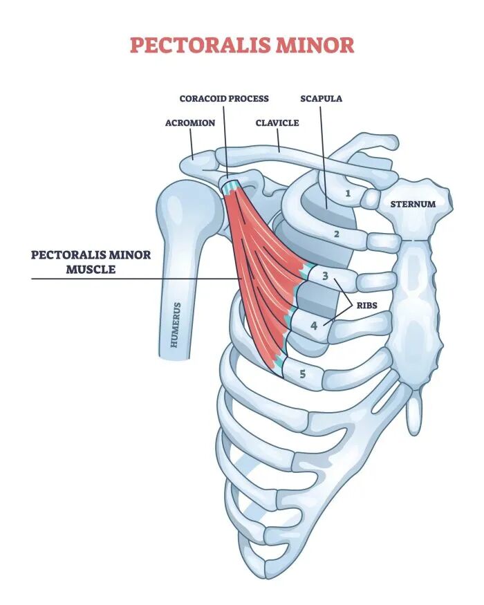 An anatomy image showing the pectoralis minor muscle.