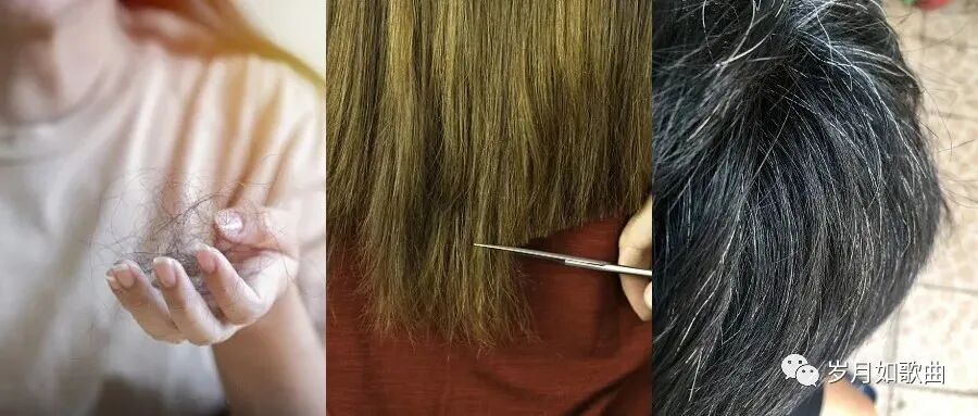 到底身体里“缺”什么，才会脱发、白发？