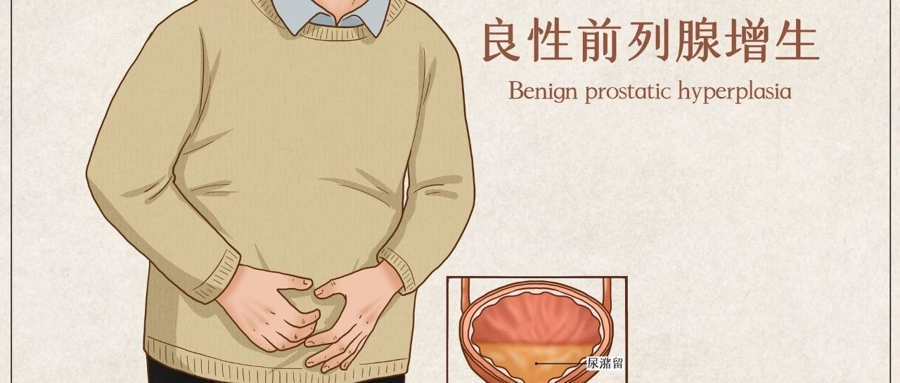告别前列腺肥大，常揉这三穴