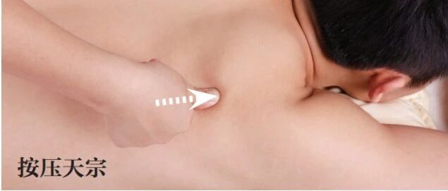 4法治肩周炎（实用穴位治疗百科）