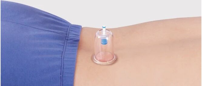 实用穴位治疗百科——4法治神经性皮炎