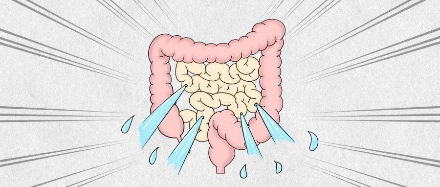 好好的肠子，怎么会「漏」了？