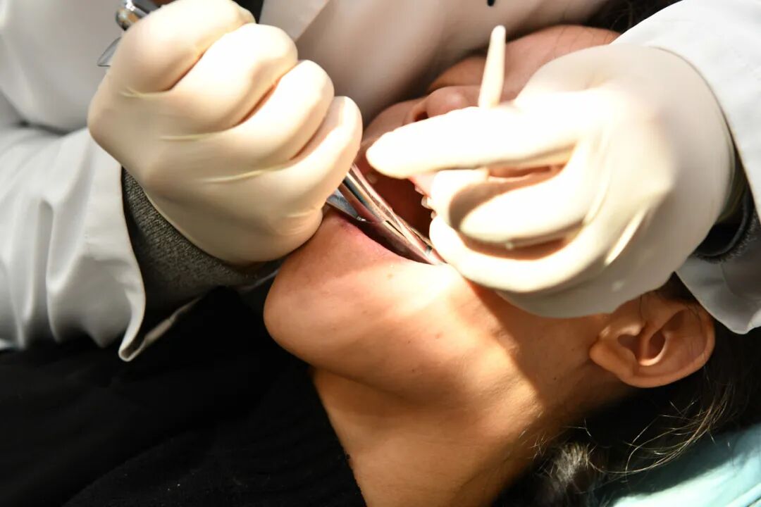 牙科骨凿怎么用嘴里那颗“智齿”到底要不要拔？纠结100次不如听牙科医生说一回_https://www.jmylbn.com_新闻资讯_第17张