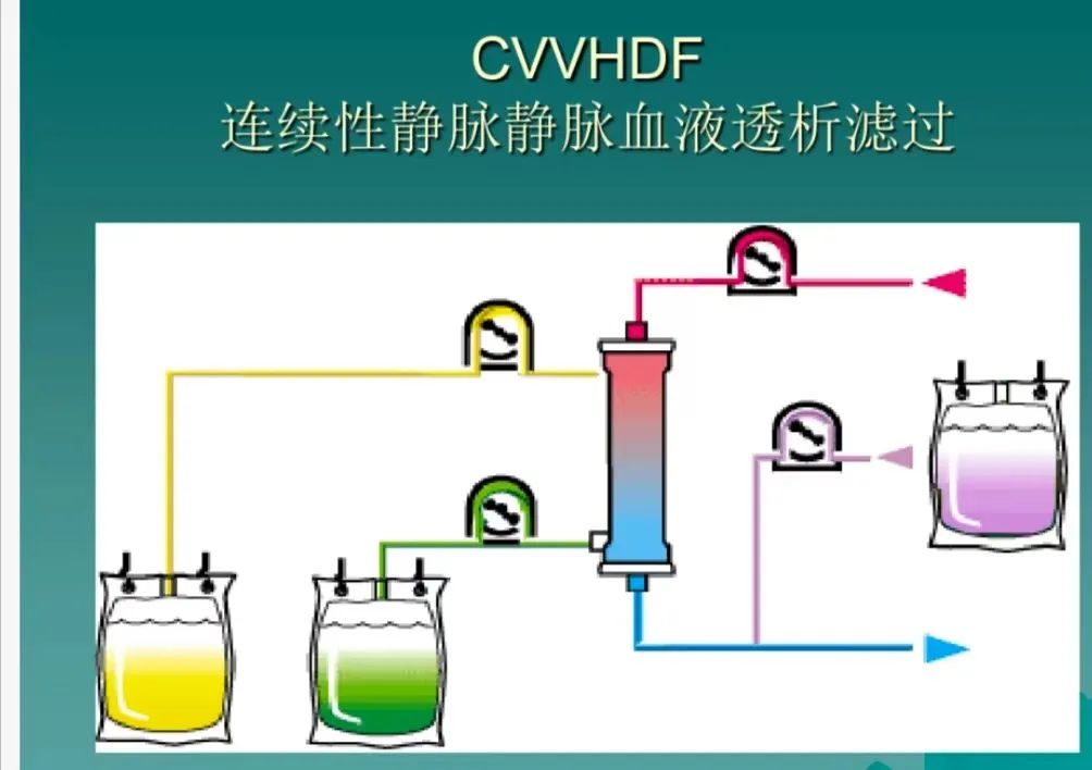 肾内科重症治疗新法宝 成功抢救危重肾友