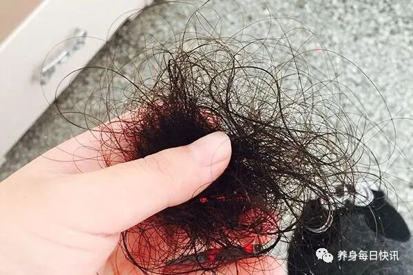 经常掉头发，是身体缺乏哪些营养？及时补充，头发或能变浓密