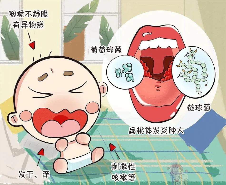 扁桃体怎么治疗