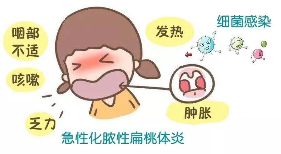 扁桃体怎么治疗