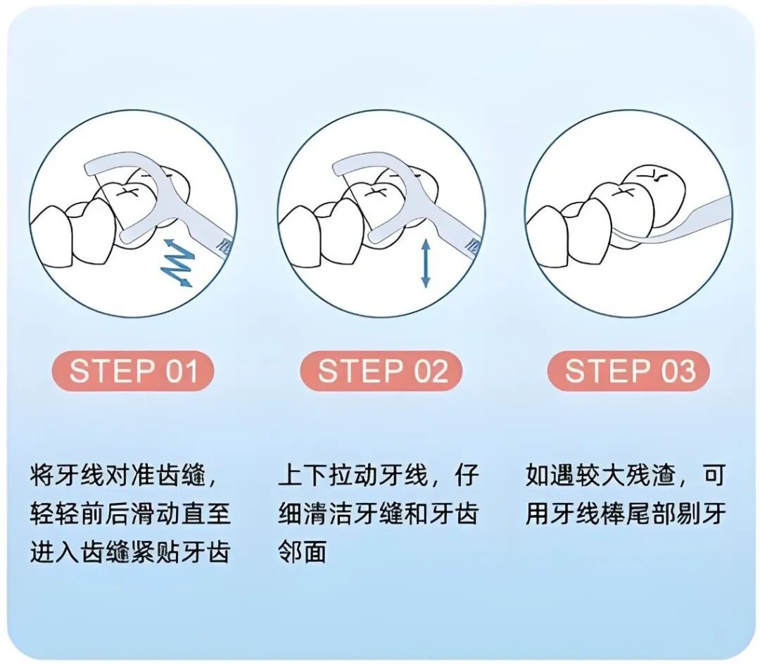 牙线的邪修用法,牙齿护理必备：牙线的使用与注意事项！