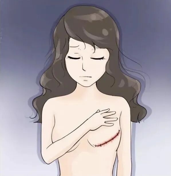 压力绷带为什么那么贵乳腺癌术后『乳房重建』让安全与美丽并存_https://www.jmylbn.com_新闻资讯_第4张