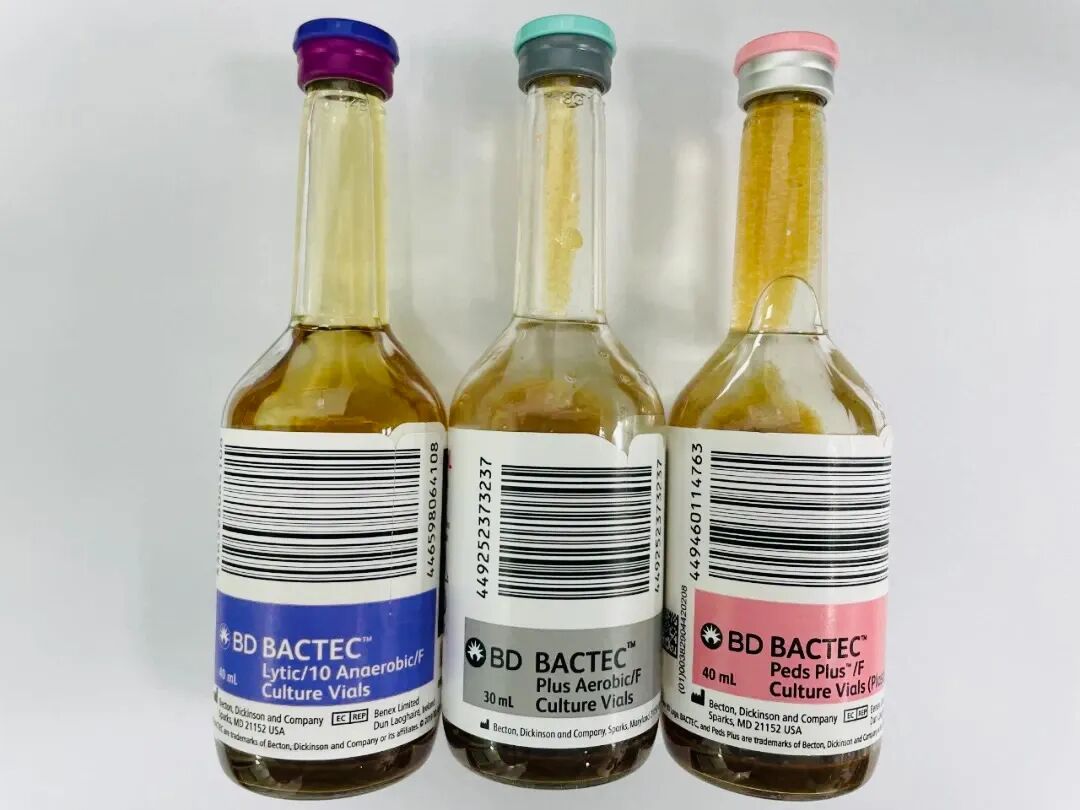 为什么用氟化钠抗凝一检真情丨七个采血管小朋友排排队_https://www.jmylbn.com_新闻资讯_第9张