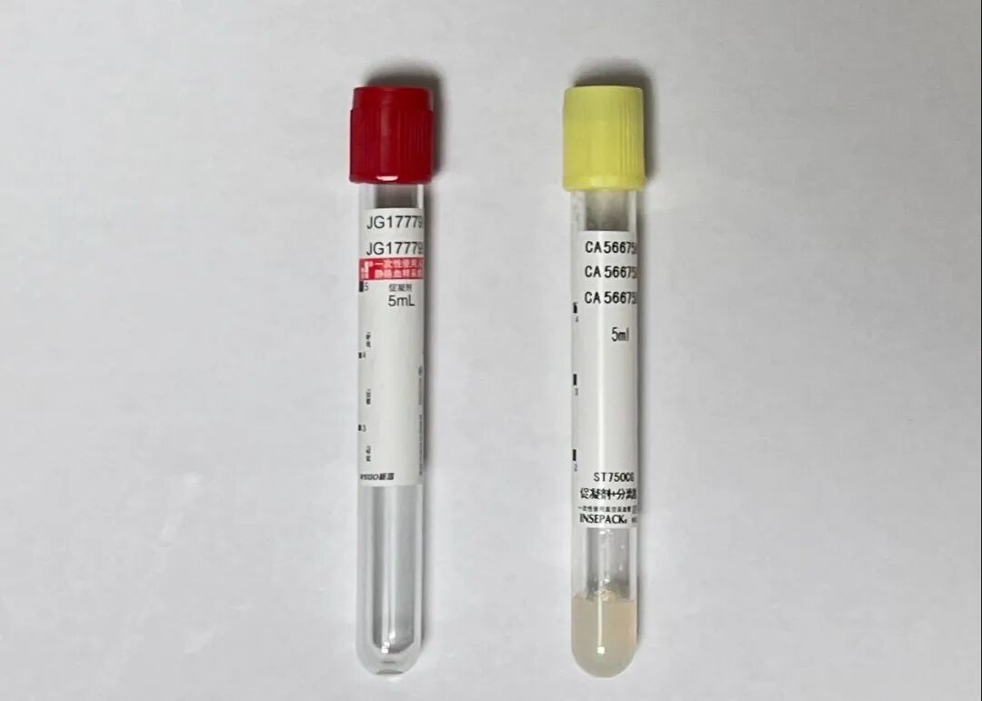 为什么用氟化钠抗凝一检真情丨七个采血管小朋友排排队_https://www.jmylbn.com_新闻资讯_第18张