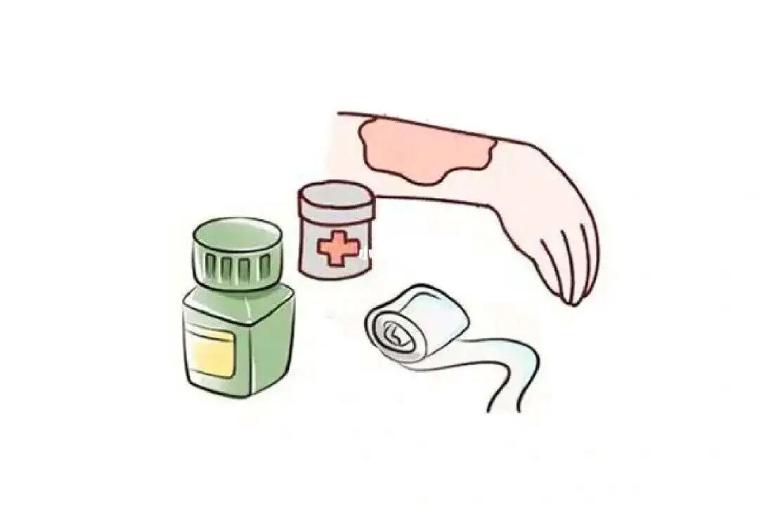 被砸肿了怎样快速消肿