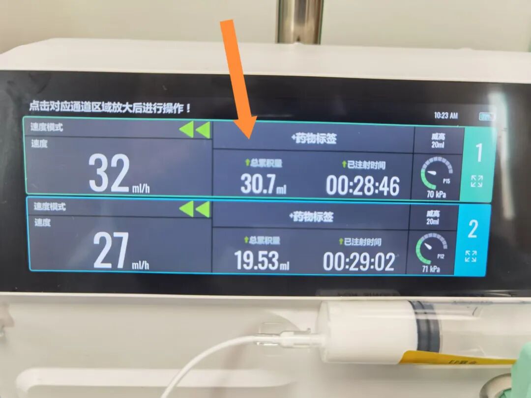 微量泵速度怎么调史上最好用的微量泵正在提供免费试用！_https://www.jmylbn.com_新闻资讯_第19张