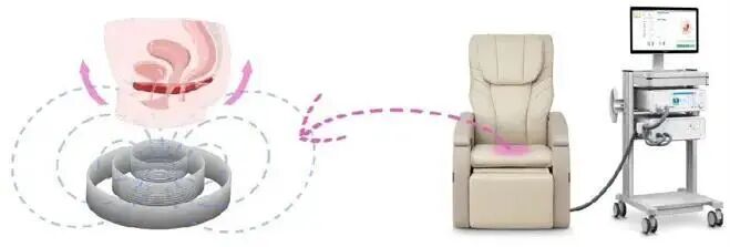 磁场刺激仪治疗什么【特色诊疗】坐“沙发”就能修复盆底？盆底磁刺激治疗仪快来了解一下_https://www.jmylbn.com_新闻资讯_第4张