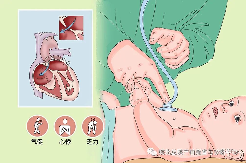 但由于难以区分正常状态的卵圆孔和异常发育的房间隔,导致房间隔缺损